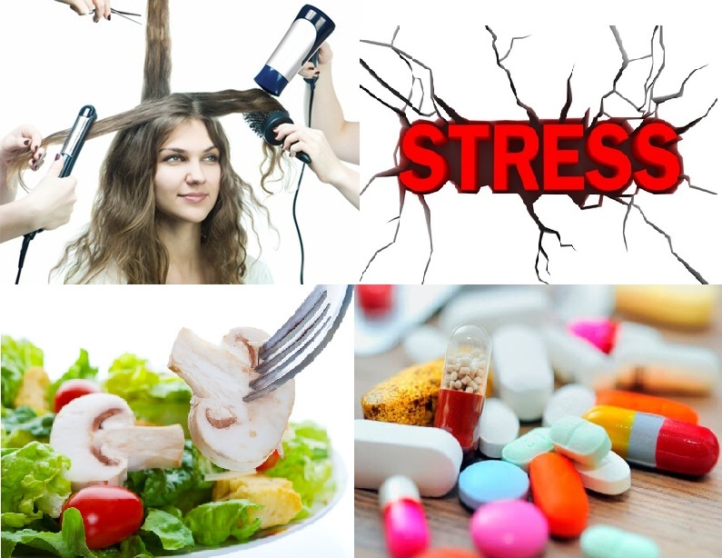 Bí quyết chống rụng tóc Bí quyết chống rụng tóc