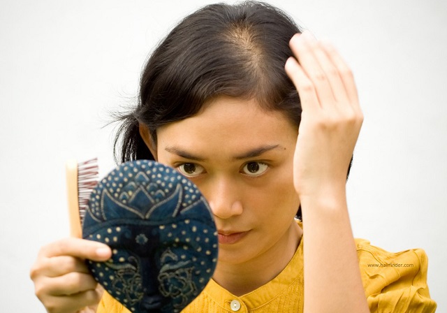 Phân biệt tóc rụng sinh lý và tóc rụng bệnh lý để biết lúc nào cần đi khám ngay