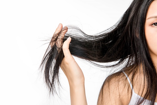 5 cách trị gàu và rụng tóc cực hiệu quả tại nhà